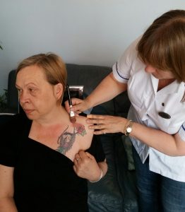 Tatoo Removal London